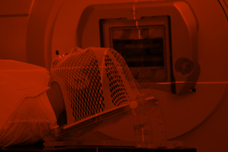 Radiotherapy head and neck cancer